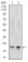 NME2 Primary Antibody MP30736T [M4G7A8]