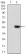 LDLR Primary Antibody  MP30767T [M1B10H10]