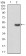 ERCC1 Primary Antibody MP30782T [M1E5B3]