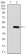 PDGFRB Primary Antibody MP30853 [M2G7B7]