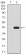 DDX20 Primary Antibody MP30898 [M7B2B1]