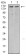 KDM6A Primary Antibody MP30956 [M6E2D6]