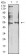 HTR3B Primary Antibody MP31295 [M2H9H5]