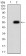 CHRND Primary Antibody MP31349 [M1H1F9]