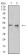 CD54 Primary Antibody MP31462 [M3A5G12]