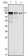 FER Primary Antibody MP20152 [M5D2C4]