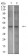 P2RY1 Primary Antibody MP31320 [M4G5D6]