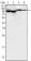 BTK Primary Antibody MP20132 [M7F12H4]