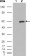 ETV1 Primary Antibody MP20281 [M1C8B6]