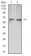 PRKAA2 Primary Antibody MP31178 [M8E11H5]