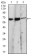EIF2AK2 Primary Antibody MP30664 [M3A10F7]