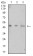 LTBR Primary Antibody MP31569 [M1D1C5C8]
