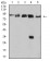 DDX1 Primary Antibody MP31065 [M3E5B2]