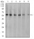 KRT10 Primary Antibody MP31133 [M3C2F5]