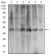 ACP5 Primary Antibody MP30539 [M7E6A11]