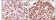 PR Primary Antibody MP20107 [M2F12B4]