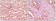 EphA2 Primary Antibody MP20071 [M1B3C7]