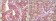 BRAF Primary Antibody MP20108 [M1H12F1]