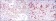CTTN Primary Antibody MP30188 [M4C6]