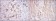 HSP27 Primary Antibody MP30213 [M5D7]