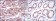 KRT19 Primary Antibody MP30226 [M1H6]