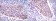 MMP1 Primary Antibody MP30236 [M6A5]