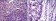XRCC5 Primary Antibody MP30237 [M5C5]