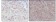 MLL Primary Antibody MP20179  [M10F8D7]