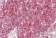 Anti-BTK Antibody IHC-plus™ MX-B14229