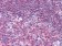PYK2 Primary Antibody MP20212 [M5E2D5]