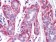 FRK Primary Antibody MP20237 [M1A8H2C12]