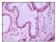 CD10 Primary Antibody MP20257 [M3G9D10]