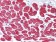 MYL3 Primary Antibody MP20343 [M7C1]