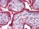 ITGA5 Primary Antibody MP20411 [M10F6]