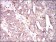 KIF11 Primary Antibody MP20442 [M3B7B2]