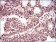 TBLR1 Primary Antibody MP20444 [M5A9G10]