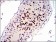 CDK4 Primary Antibody MP20445 [M4C5H9]