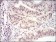 CDK4 Primary Antibody MP20445 [M4C5H9]