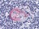 akt  IHC