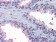 BDH1 Primary Antibody MP30003 [M1A5]