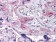 ERN1 Primary Antibody MP30026 [M9F2]