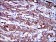 KRT19 Primary Antibody MP30249 [M4E8]