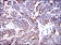 KRT19 Primary Antibody MP30249 [M4E8]