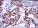 KRT19 Primary Antibody MP30249 [M4E8]
