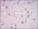 MMP9 Primary Antibody MP30251 [M5G3]