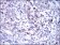 KID Primary Antibody MP30275 [M5F3]