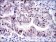 KID Primary Antibody MP30275 [M5F3]