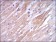 TNNI2 Primary Antibody MP30276 [M2F12A11]