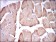 TNNI2 Primary Antibody MP30276 [M2F12A11]