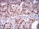 KID Primary Antibody  MP30277 [M1E3]